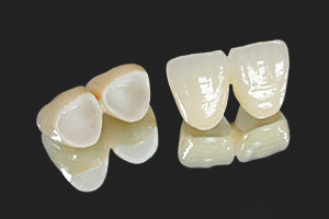 cirkon fémmentes fogpótlás